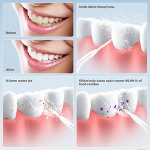 Sejoy Irrigator Dental Mouth Washing Flosser Machine