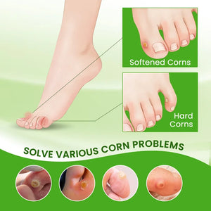 30g Foot Corn Remover Cream