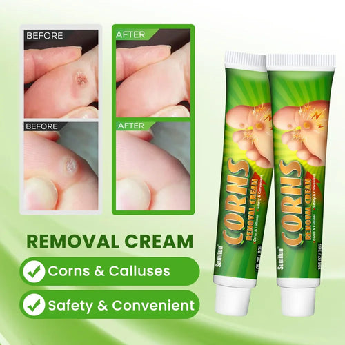 30g Foot Corn Remover Cream